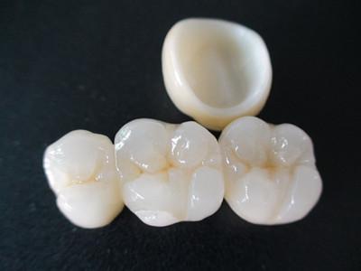 Easy the whole porcelain tooth