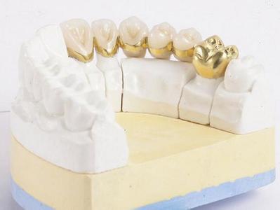 Easy the whole porcelain tooth
