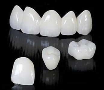 Zirconium dioxide all porcelain crown