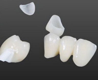 Zirconium dioxide all porcelain crown