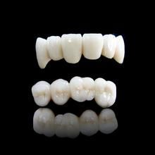 Zirconium dioxide all porcelain crown